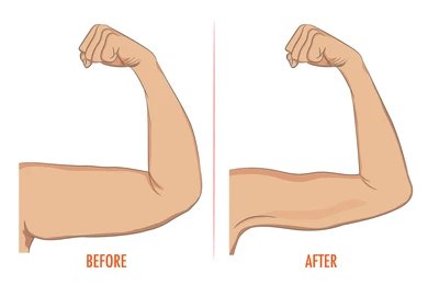 The Hidden Link Between Vitamin D Deficiency and Age-Related Muscle Loss