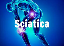 Weight Loss and Sciatica Pain Relief: The Connection Explained