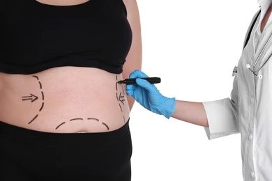 Does Cigna Cover Weight Loss Surgery